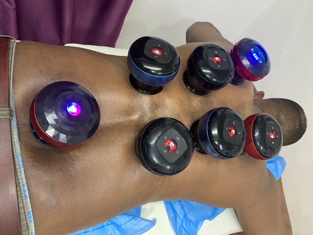 Rashid Hijama cupping Services, Johannesburg South Africa