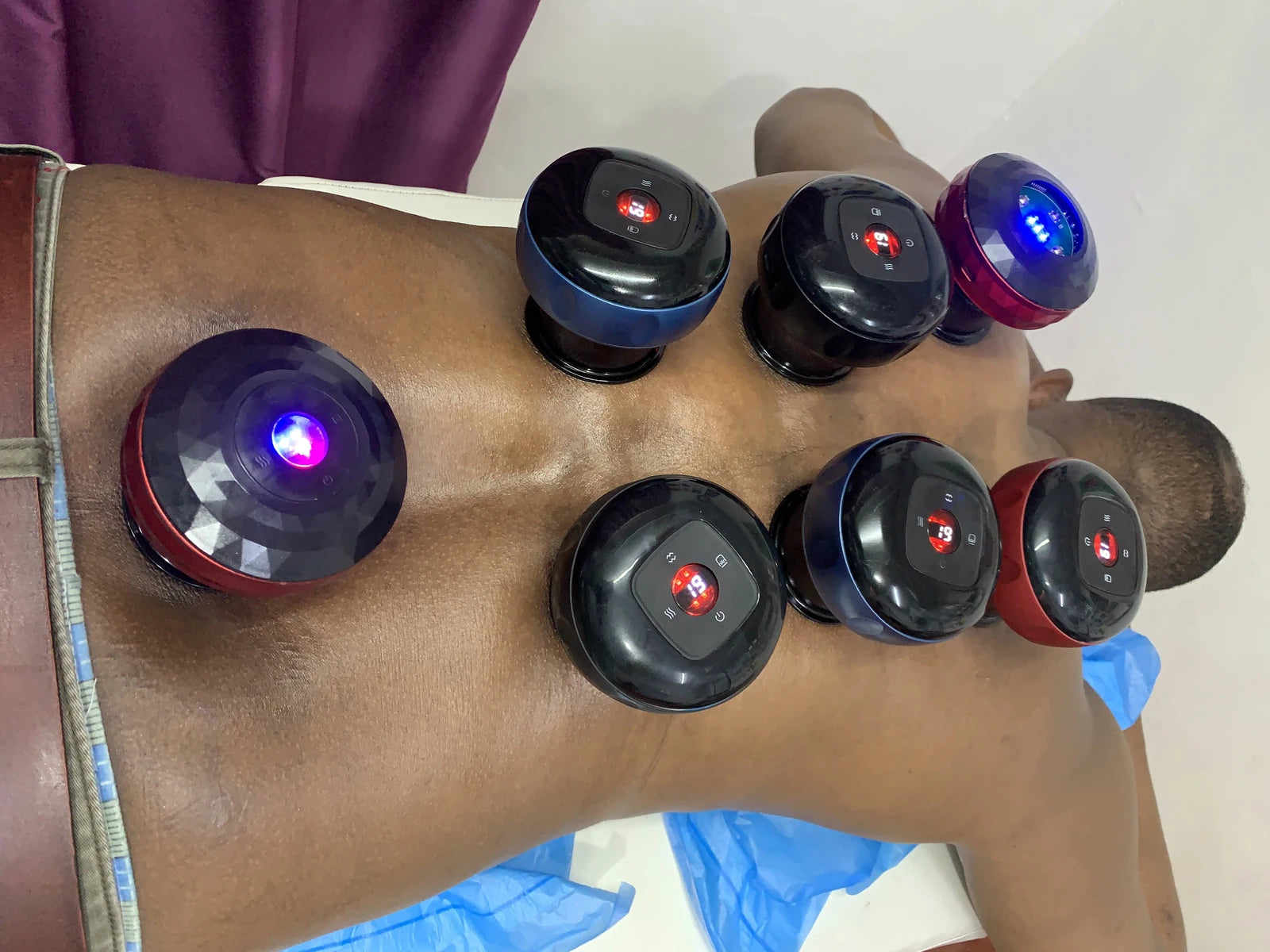 Rashid Hijama cupping Services, Johannesburg South Africa