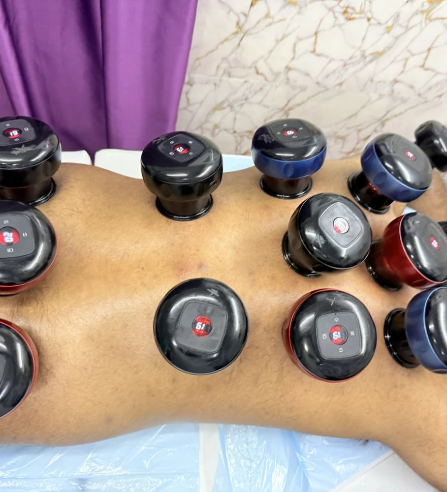 Rashid Hijama cupping Services, Johannesburg South Africa
