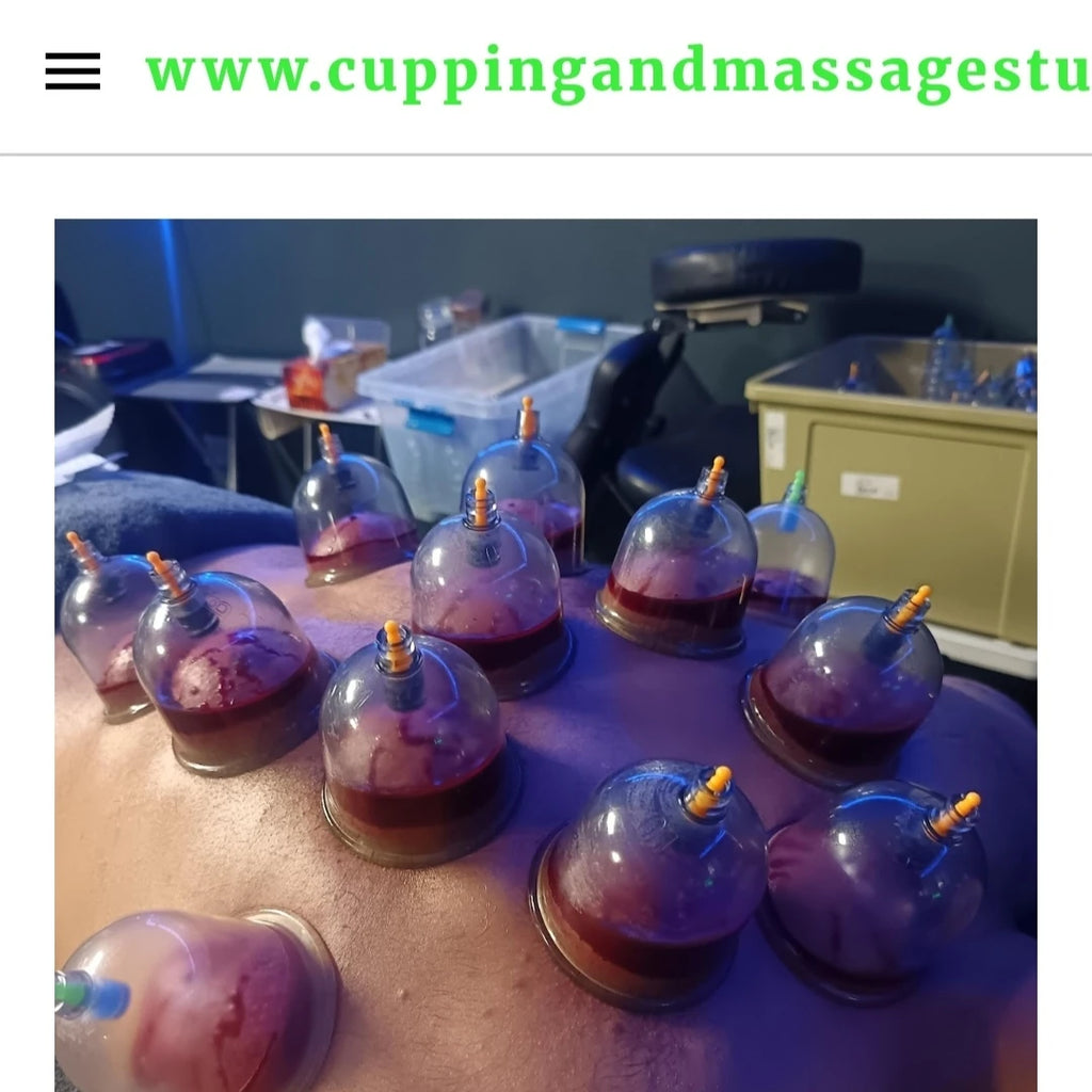 Rashid Hijama cupping Services, Johannesburg South Africa